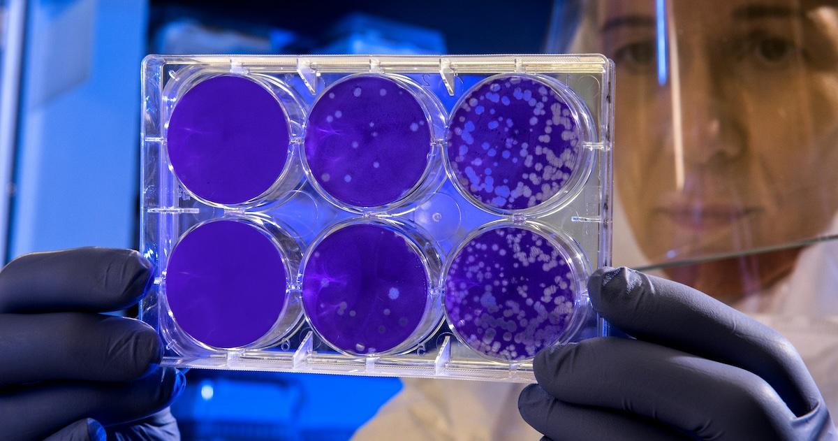 stem cell