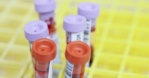 A closeup of purple and red blood vials