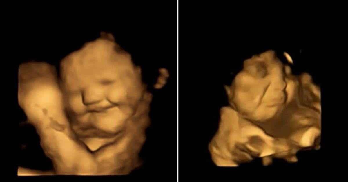 Laughing and grimacing reactions of fetuses when fed with carrots and kale respectively (Cover Image Source: X | @Durham_uni)