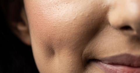 A close up of one side of a woman's face with a dimple in the middle of her cheek.