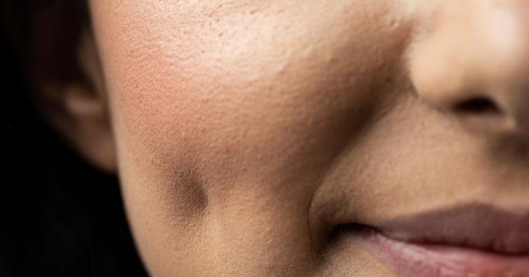 What Is a Dimple Maker? Social Media's At-Home Dimple Trend