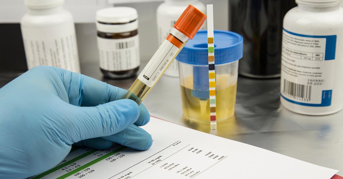 cbd panel drug test