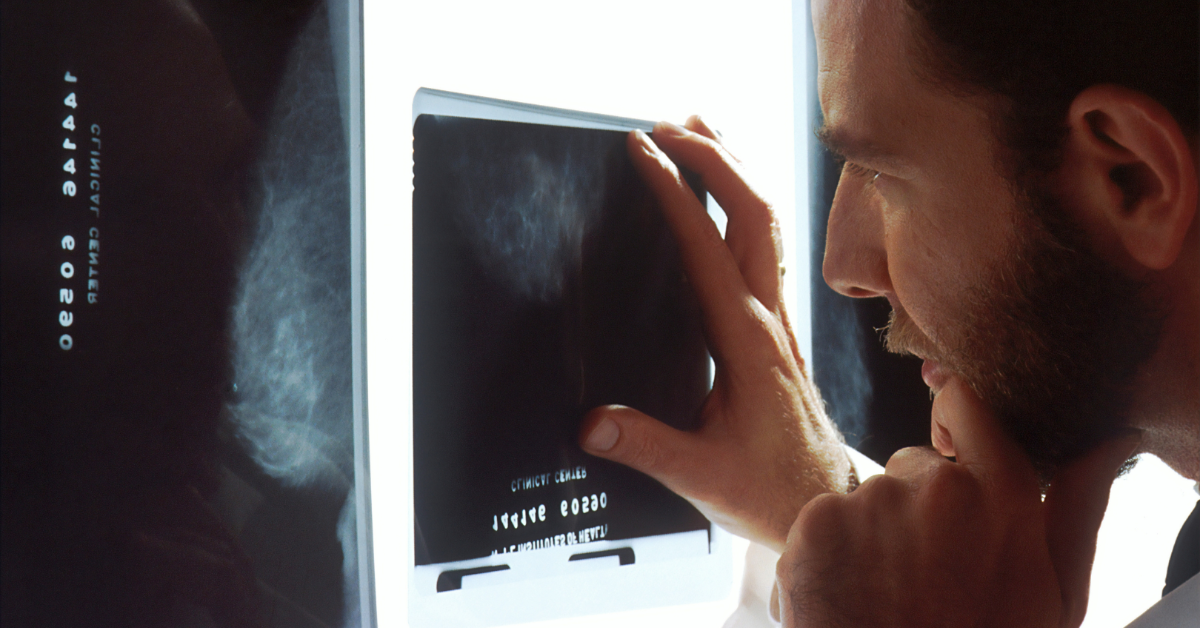 A closeup of a doctor reading mammogram results