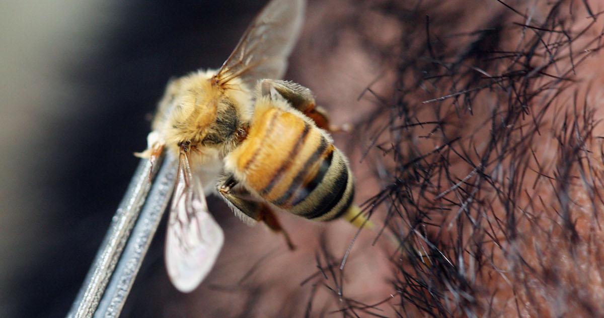 Bee stinging skin