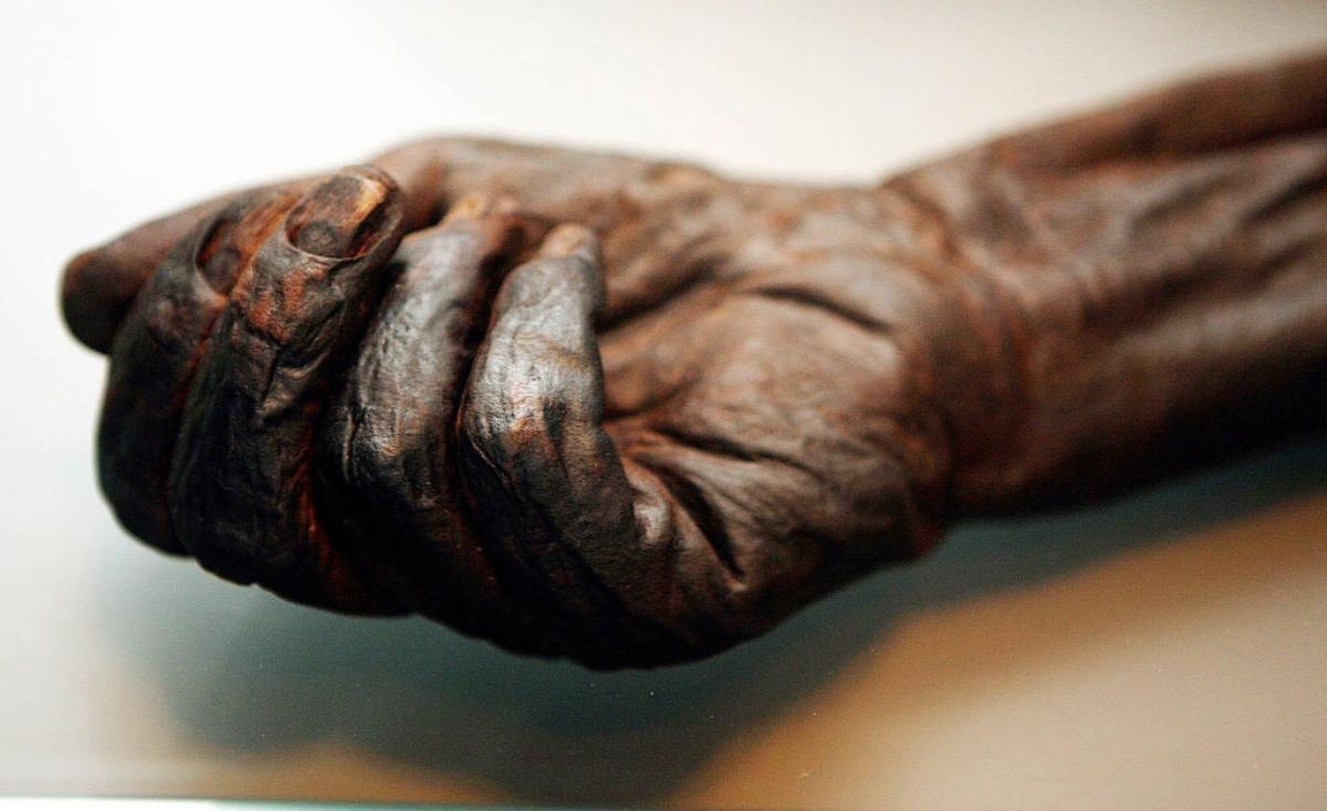 preserved hand and wrist from bog body