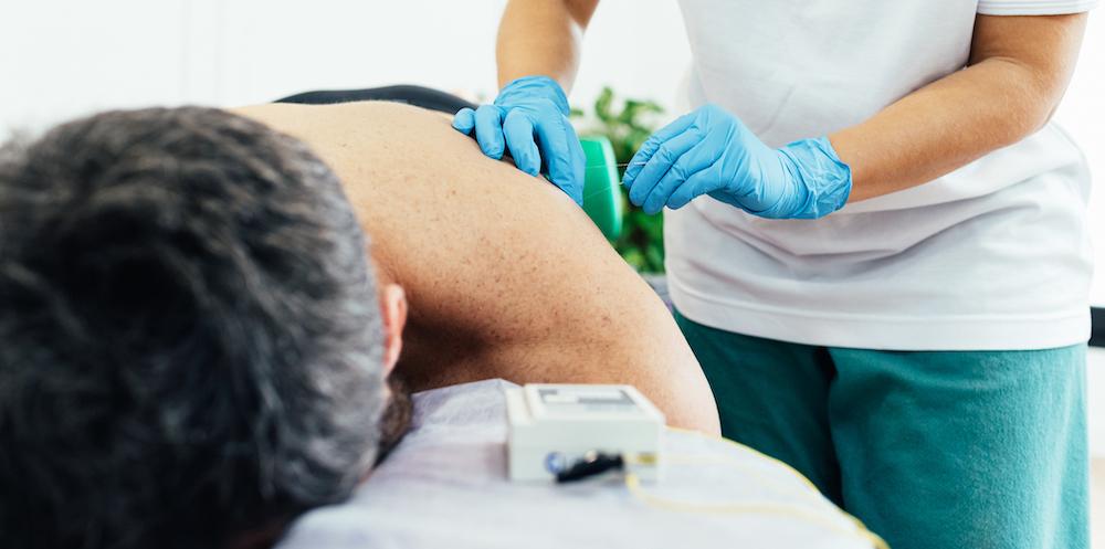 A man having dry needling done.