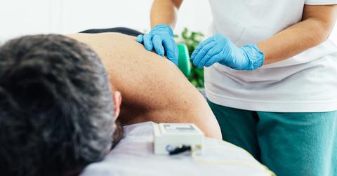 A man having dry needling done.