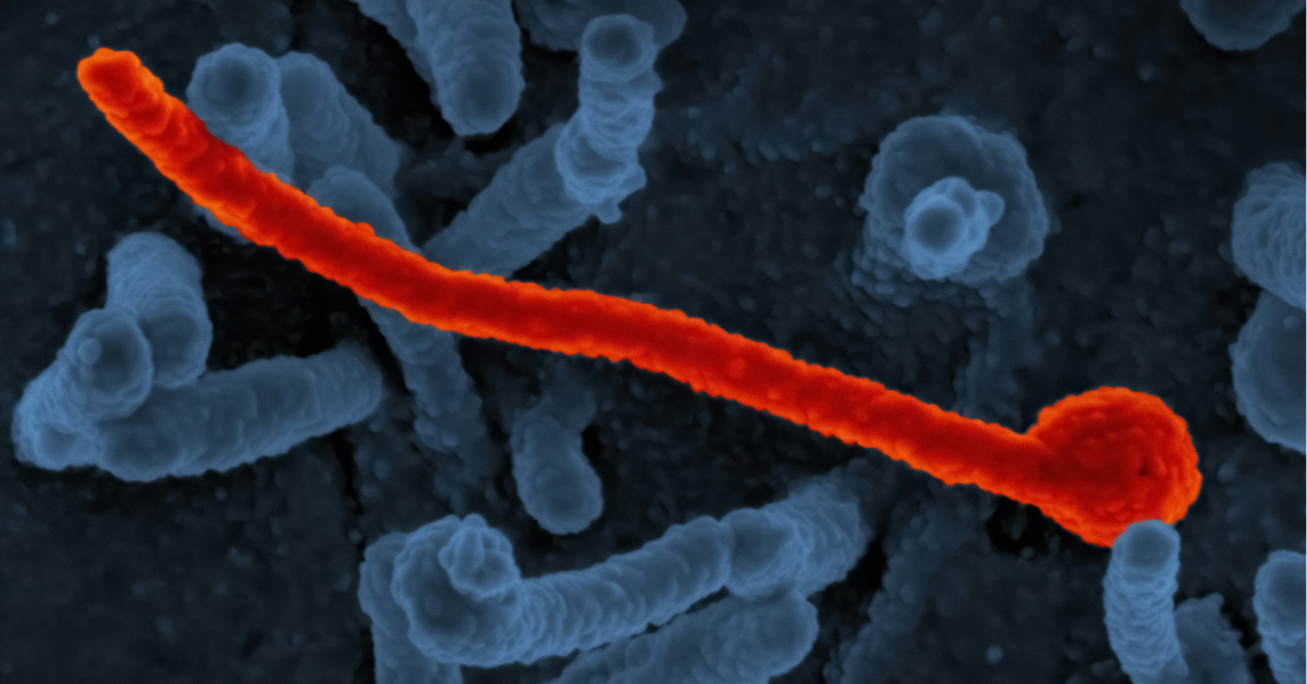Closeup of a strain of the Ebola virus