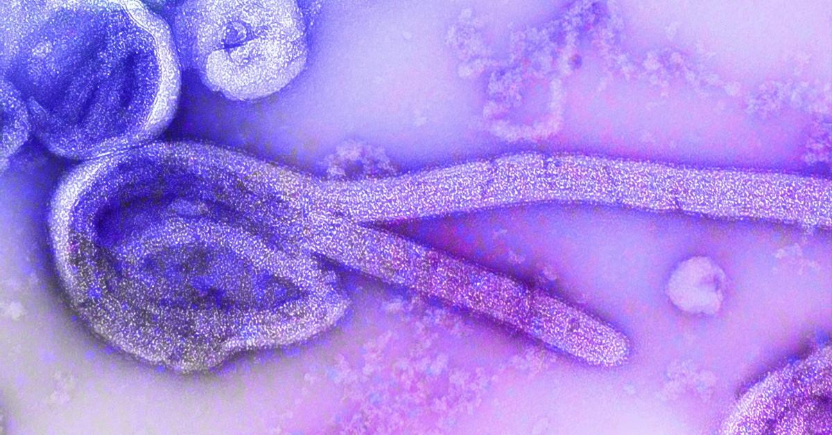 A closeup of the Ebola virus under a microscope