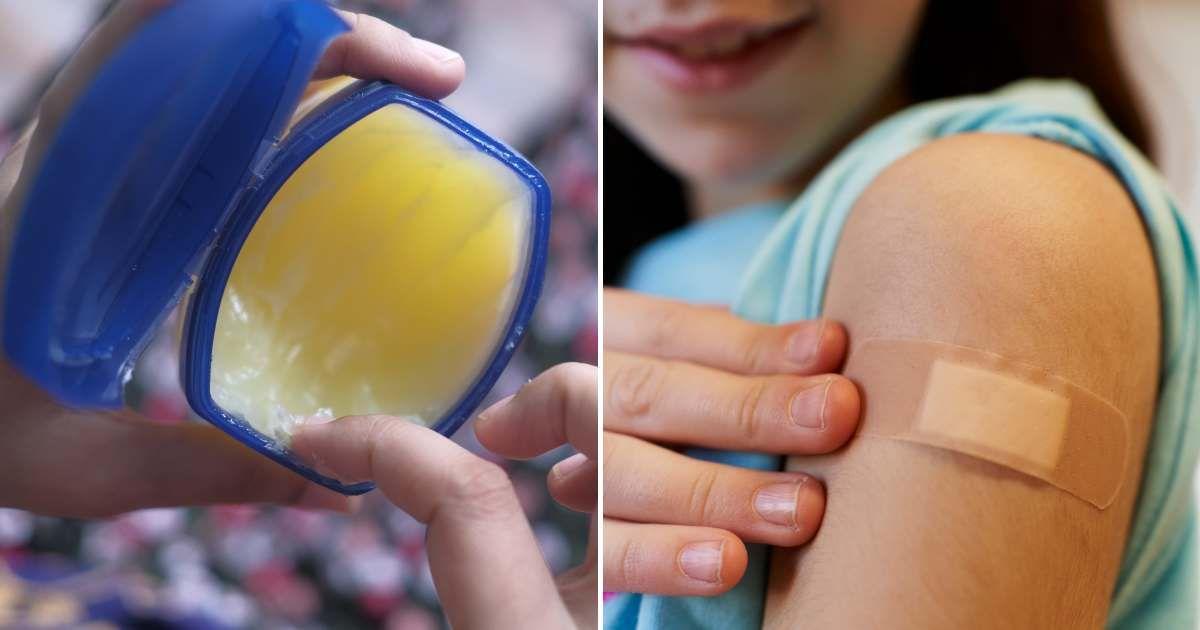 (L) A person scooping a bit of vaseline using their finger. (R) A little girl with a bandaid on her arm. (Representative Cover Image Source: Getty Images | (L) Towfiq Ahamed, (R) Aire Images)