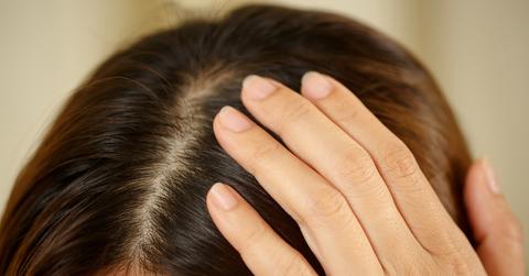 A person with dark hair holds the top of their scalp.