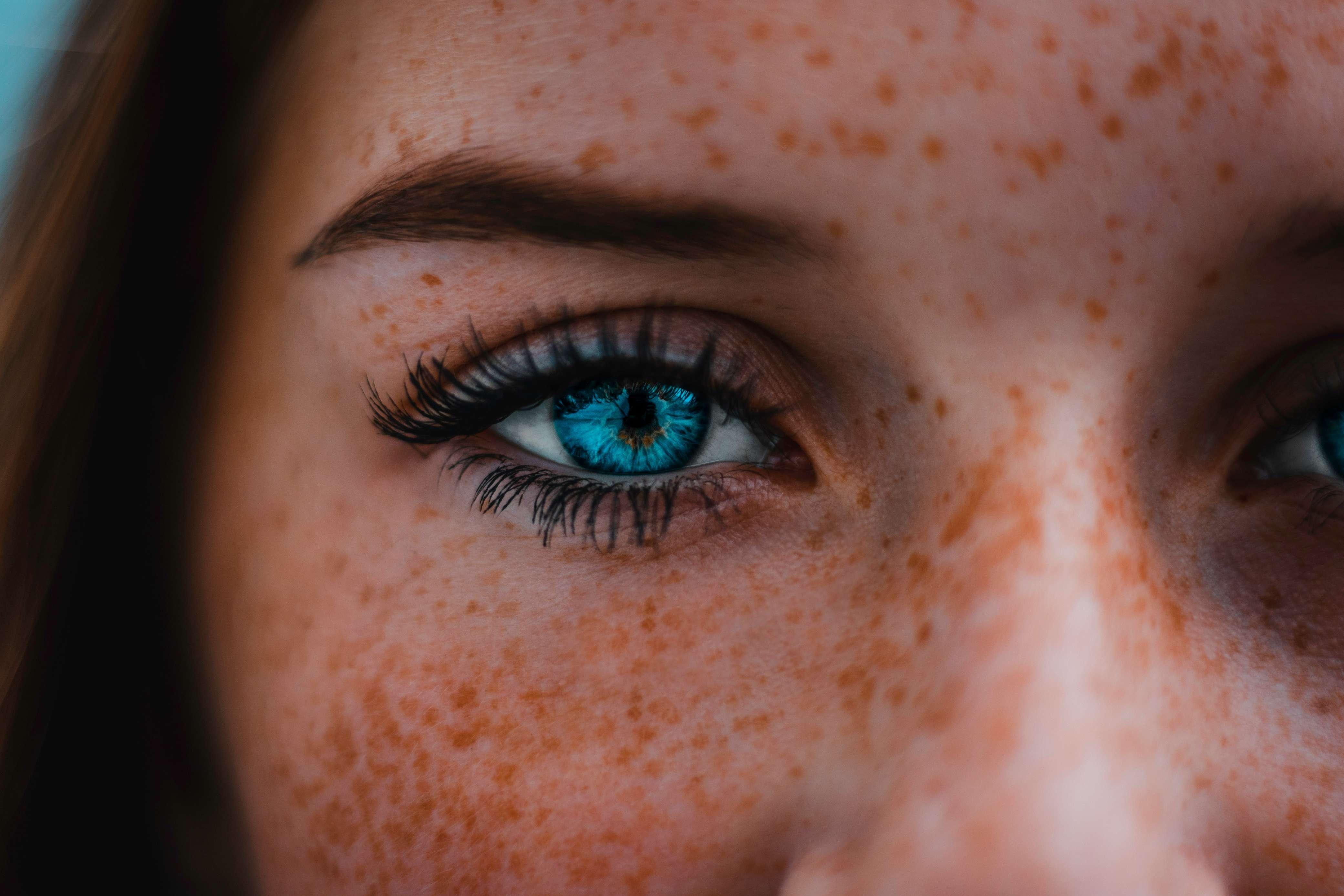 A woman with freckles and with crystal blue eyes is pictured staring straight ahead.