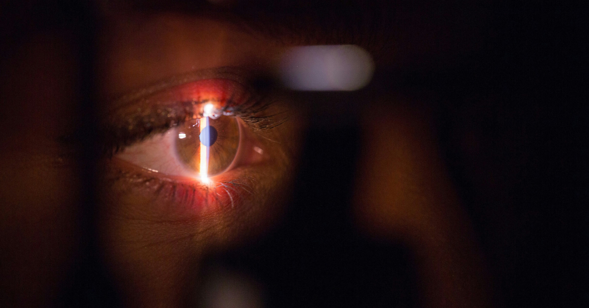 A closeup of an eye being exposed to a laser