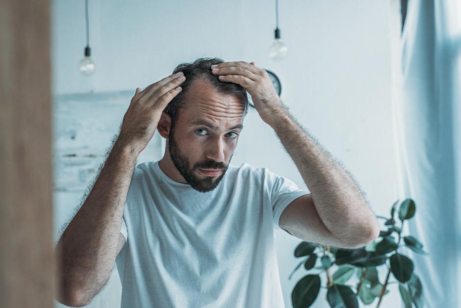 A man in a white shirt looking in the mirror and touching his hair line. 