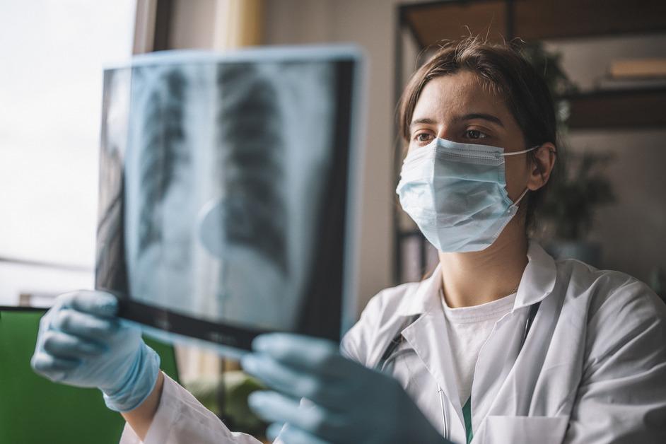 A female doctor holds up an x-ray of lungs. 