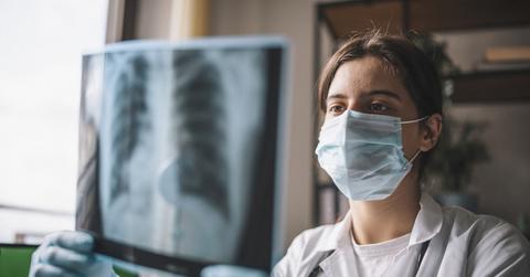 A female doctor holds up an x-ray of lungs.