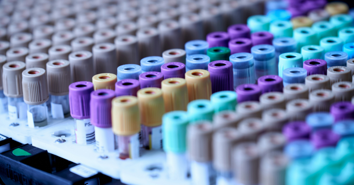 A closeup of a collection of testing vials