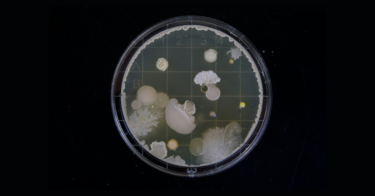 Bacteria and mold grow under a microscope slide
