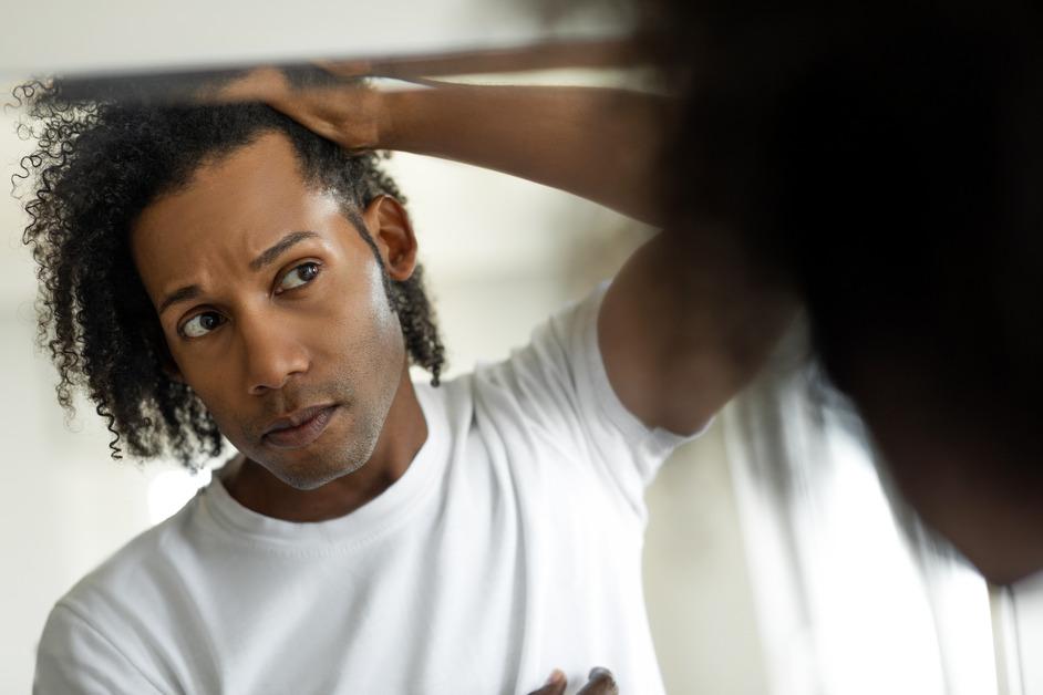 Man checking his hair for bald spots and hair loss. 