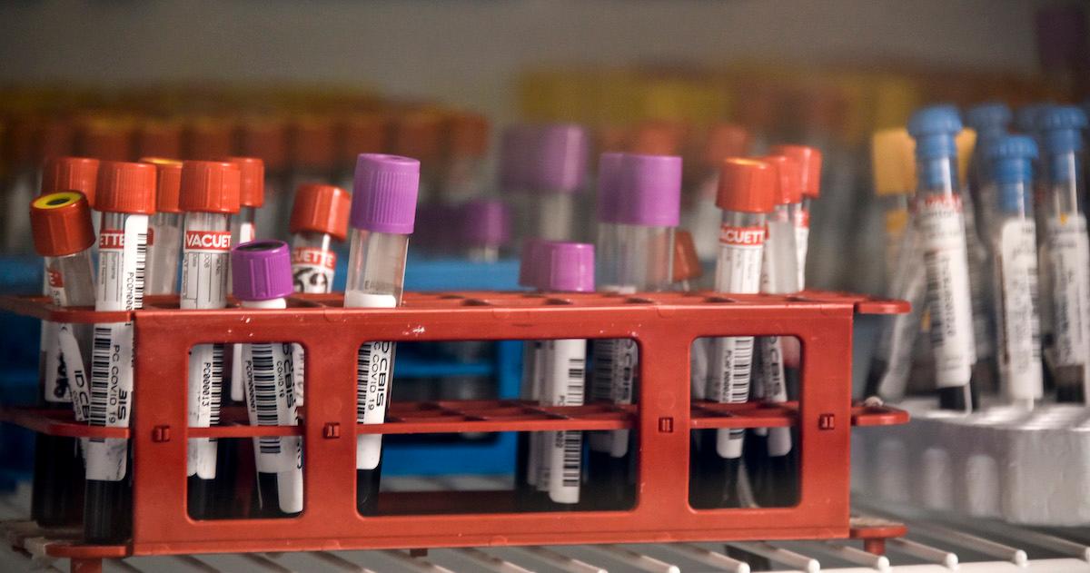 Various vials of blood samples are seen lined up in a lab.