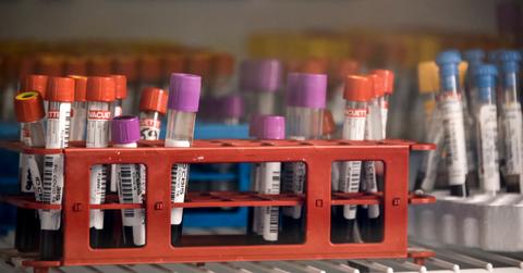 Various vials of blood samples are seen lined up in a lab.