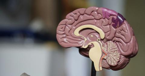 Half of a plastic replica of a brain sits atop a stand, exposing different regions