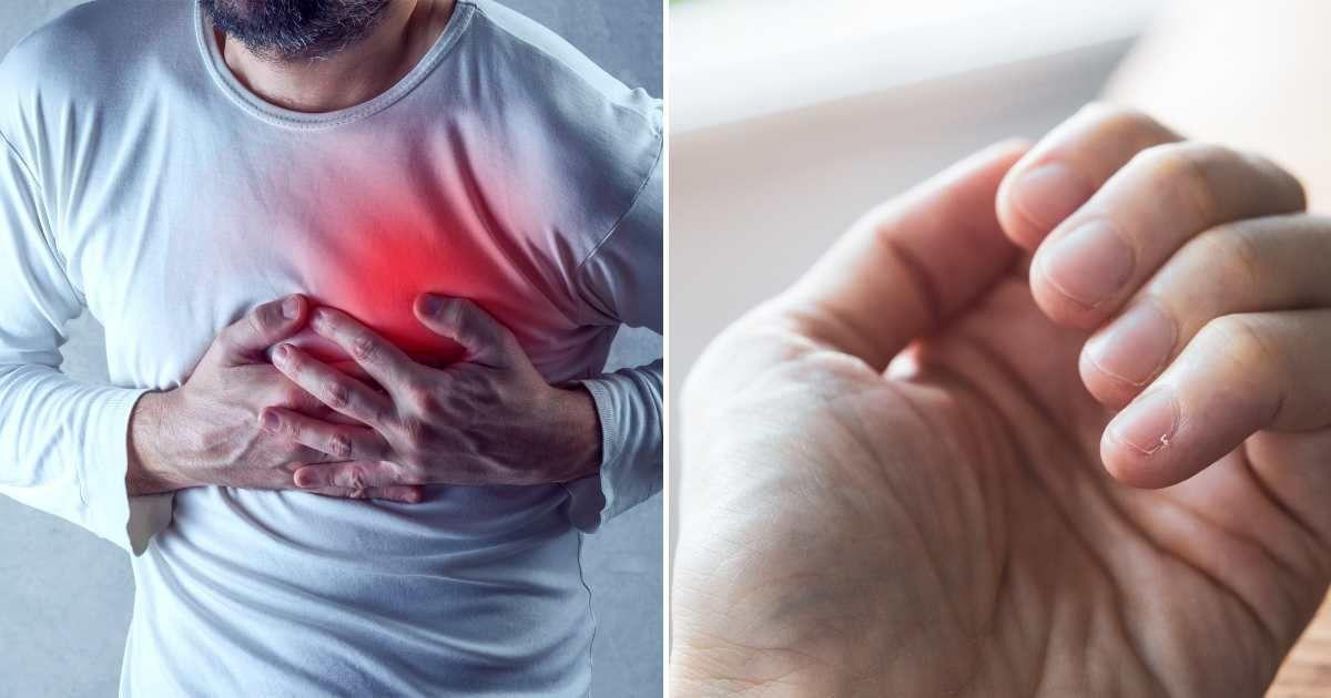 (L) A man having a heart attack holds his chest. (R) Close-up image of a person's finger nails. (Representative Cover Image Sources: Getty Images | (L) Stevanovicigar, (R) Basak Gurbuz Derman) 