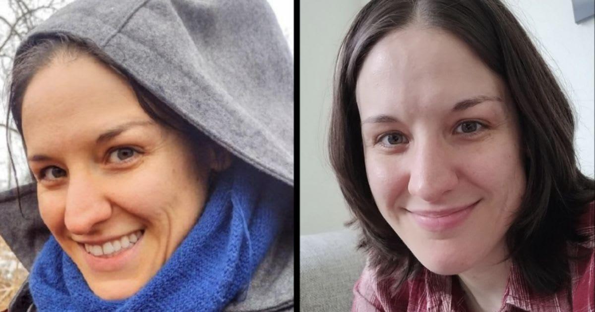 Woman compares her skin tone before and after carotenosis. (Cover Image Source: Reddit | u/AhsewkaTano)