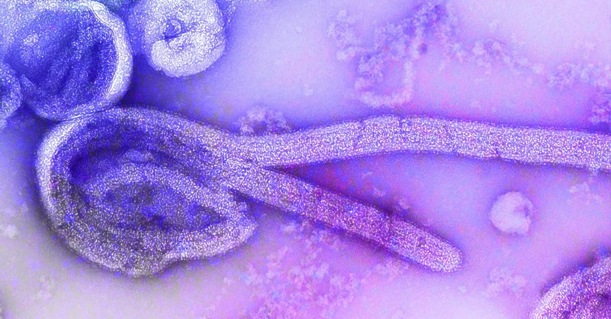 A strain of the Ebola virus appears under a microscope