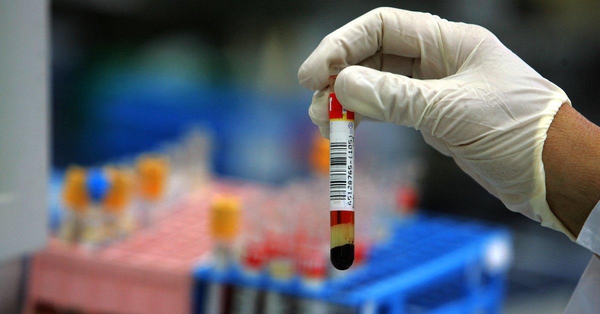 A hand wearing a medical glove holds up a vial of blood, with other blood samples seen in the background.