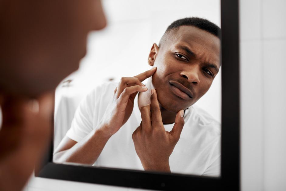 A young man popping pimples in the bathroom mirror.