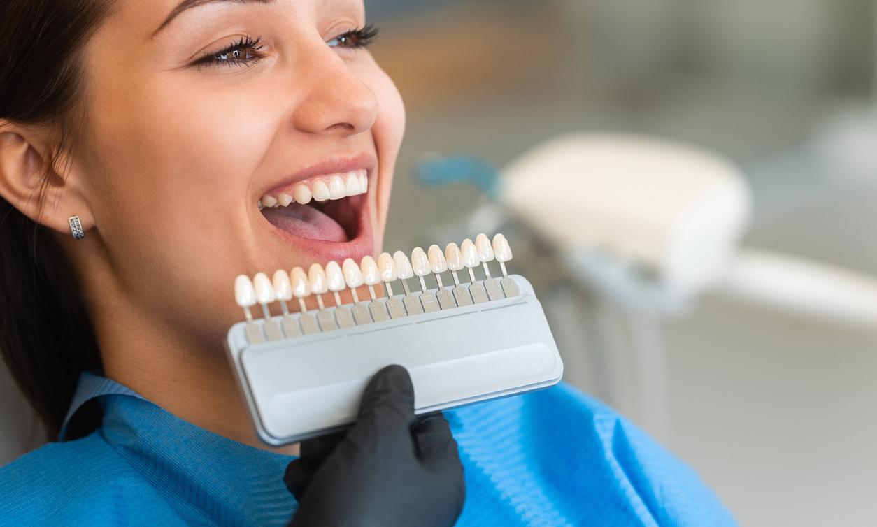 Veneers Cost How Much? Details on the Popular Vanity Trend