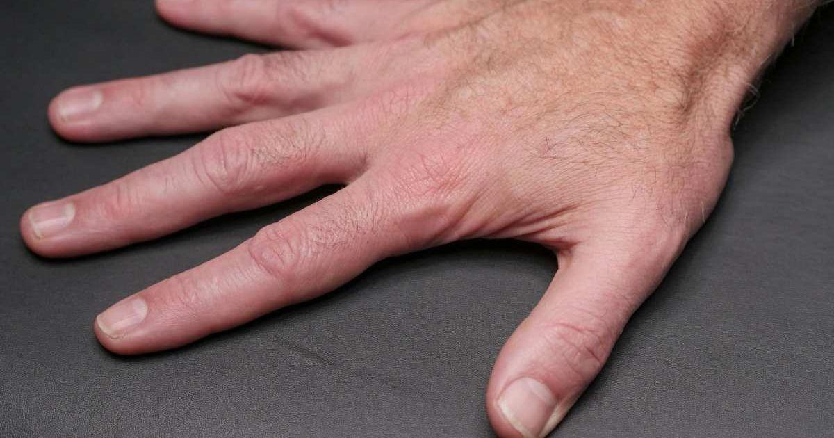 A close-up image of a person's fingernails. (Representative Cover Image Source: Pexels | Kindel Media)