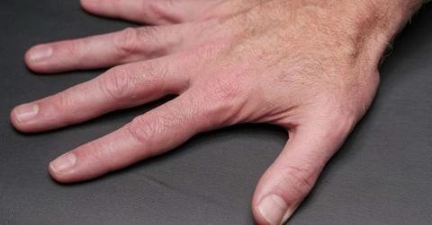 A close-up image of a person's fingernails. (Representative Cover Image Source: Pexels | Kindel Media)
