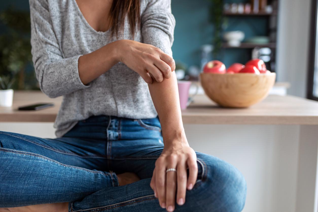 A person sits cross-legged while itching their left forearm due to eczema.