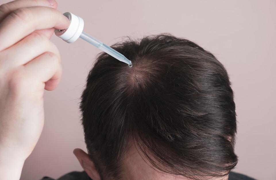 Close up of a man applying a hair treatment to a bald spot on his scalp in front of a pink background. 