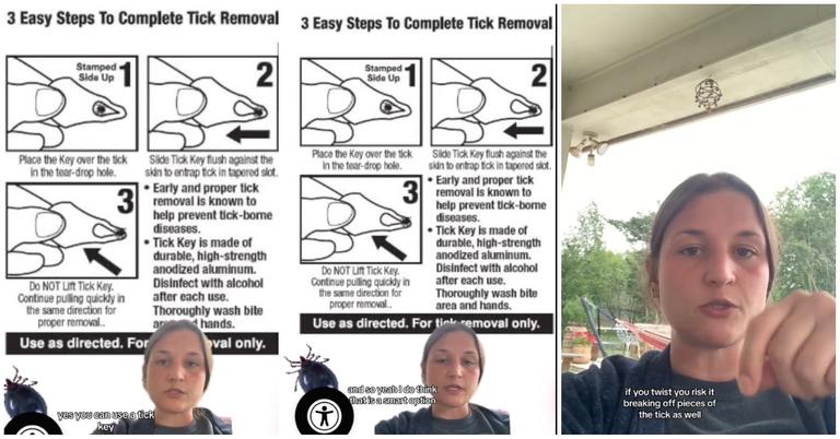 One Woman Warns People on the Proper Way to Remove Ticks