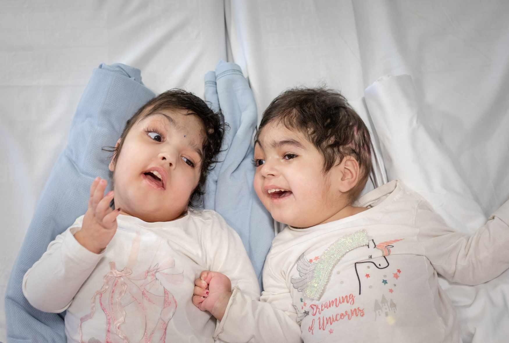 Twin sisters smile together following separation surgery.