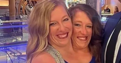 What Happens When One Conjoined Twin Dies?