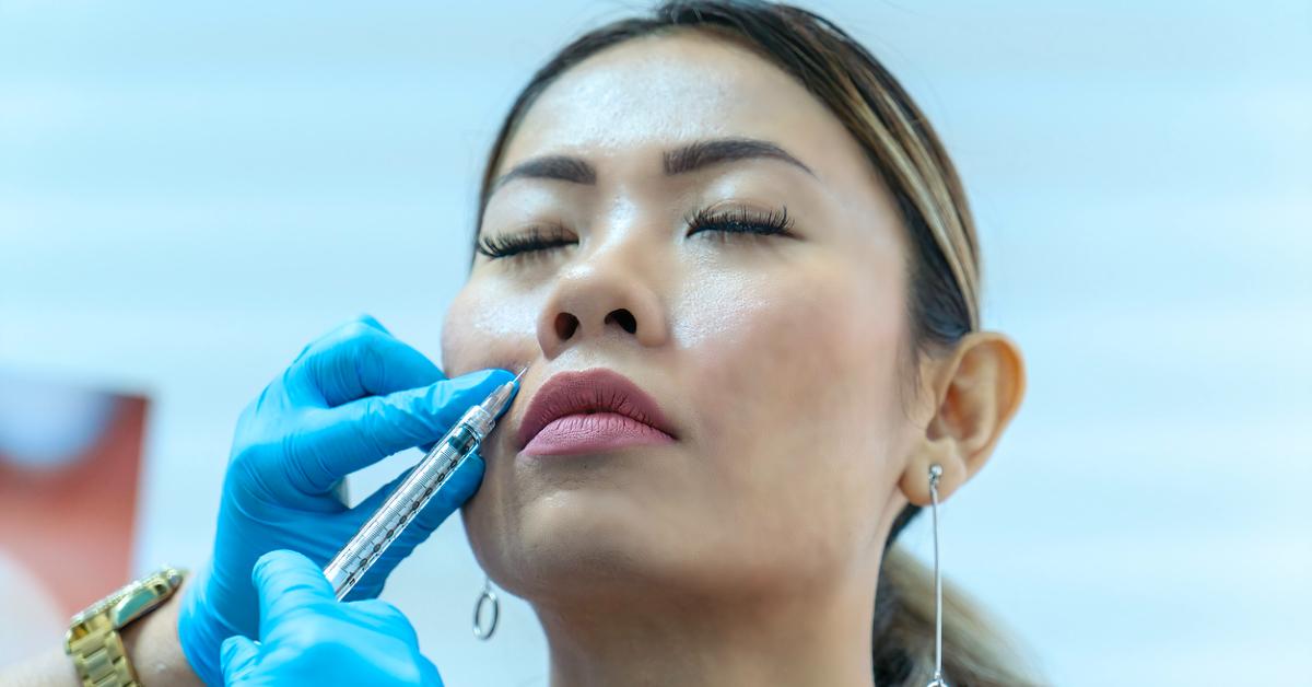 Photo of woman receiving a dermal filler injection in her right cheek area