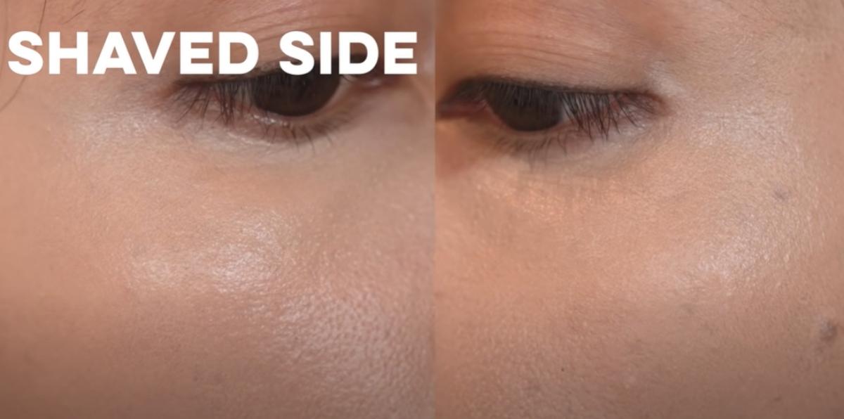 Dermaplaning Before & After Pictures: My Skin Has Never Felt So Good! - swvsmp7