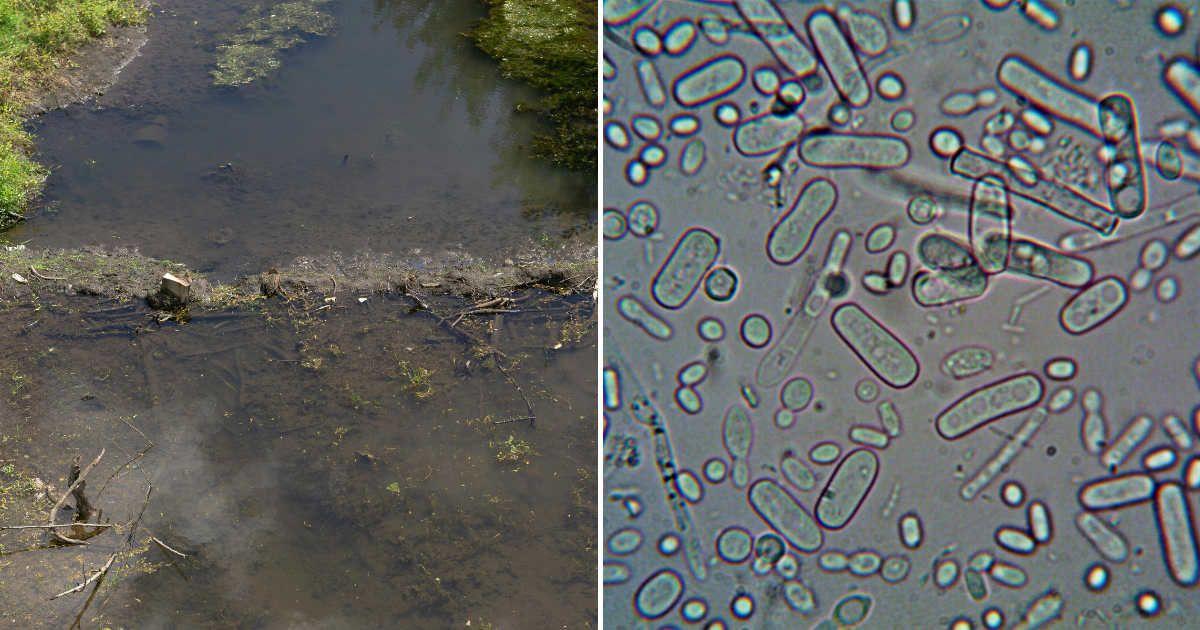 (L) Murky water in a pond. (R) Microbial organisms under a microscope. (Representative Cover Image Source: Pexels | (L) Chickenbunny, (R) Turek)