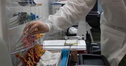 CDC Announces Discontinuation of Testing for 31 Diseases, Including Rabies