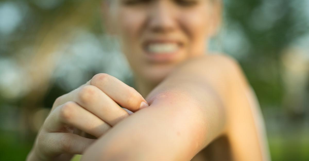 homemade mosquito repellent