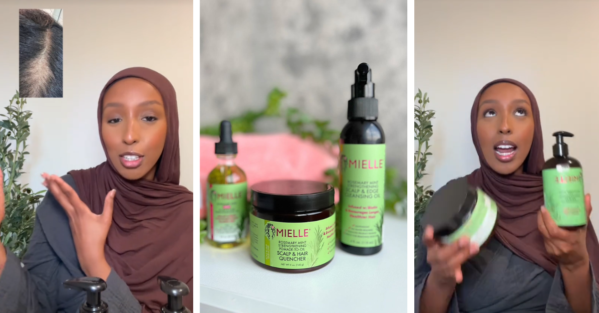 A woman explains how she experienced hair loss after using Mielle Organics