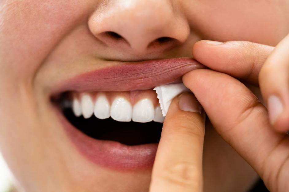 A close up of a woman putting a nicotine pouch in her mouth on her gums. 