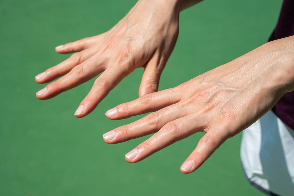 A person holds out their hands with prominent veins with a green background.